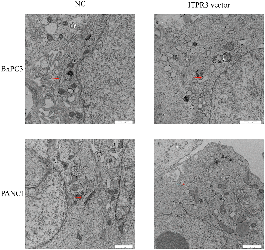 ITPR3 overexpression induces endoplasmic reticulum stress (ERS) in pancreatic cells.