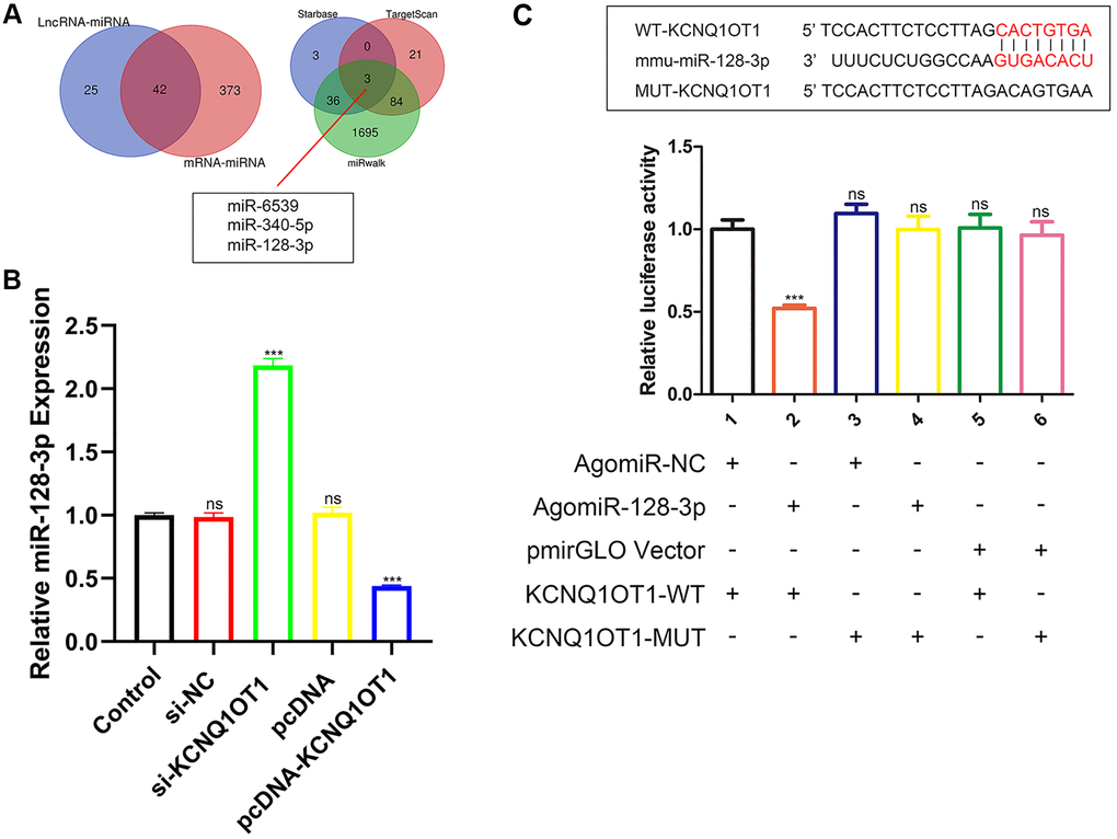 KCNQ1OT1 directly targets miR-128-3p. (A) StarBase, miRwalk and TargetScan databases showing that miR-128-3p might be a potential target of KCNQ1OT1. (B) Relative expression of miR-128-3p in RAW 264.7 cells transfected with pcDNA-KCNQ1OT1, si-KCNQ1OT1, or corresponding control vectors. (C) StarBase database was used to predict the binding site between KCNQ1OT1 and miR-128-3p. Dual-luciferase reporter assays on HEK-293T cells transfected with agomiR-NC or agomiR-128-3p in wild-type (WT) and mutant-type (MUT) groups. ***P 