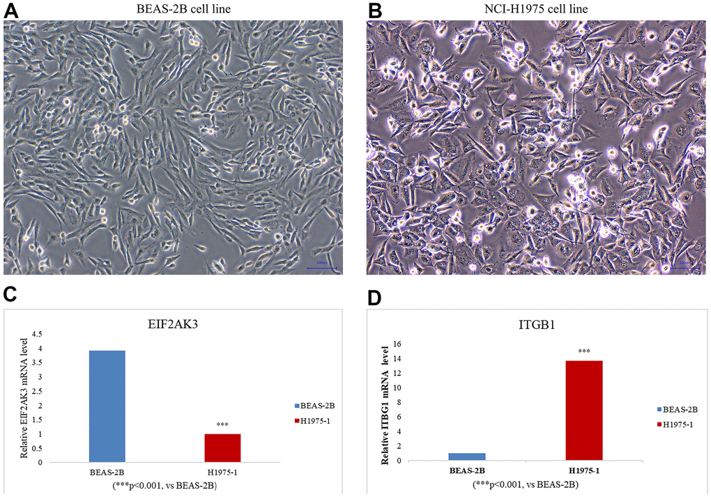 Cell line culture of (A) BEAS-2B (human normal lung epithelial cells) and (B) NCI-H1975 (human lung adenocarcinoma cells). The expression levels of EIF2AK3 (C) and ITGB1 (D) in LUAD cell lines were detected by RT -qPCR. LUAD cell line: NCI-H1975. Data were means ± SEM. ***P 