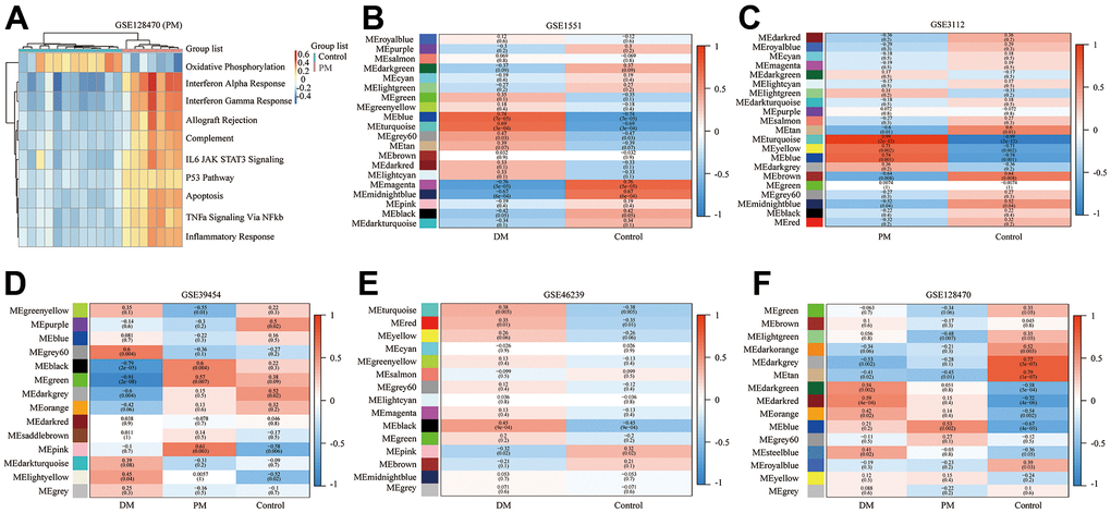 Gene set variation analysis (GSVA) of GSE128470 (polymyositis, PM) and weighted gene co-expression network analysis (WGCNA) results of five datasets. (A) GSVA result of GSE128470 (PM); (B) WGCNA result of GSE1551; (C) WGCNA result of GSE3112; (D) WGCNA result of GSE39454; (E) WGCNA result of GSE46239; (F) WGCNA result of GSE128470.