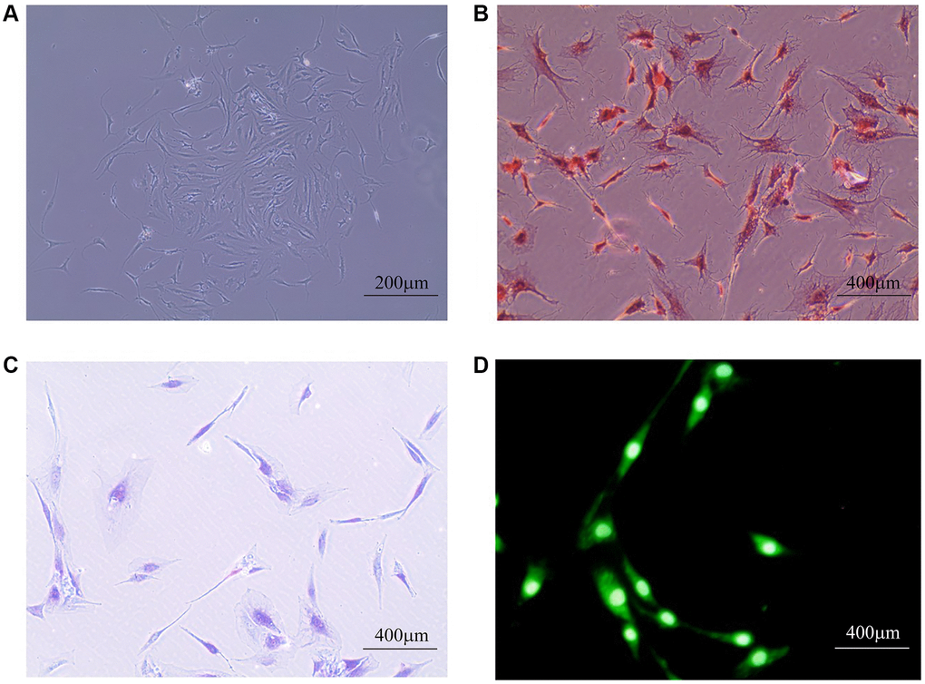 Human primary NPC identification. (A) The general morphology of primary NPCs, which mainly were star-shaped, long fusiform, polygonal or irregular under the microscope; (B) Safranin-O fast green staining: NPCs nucleus is stained dark red, cytoplasm is lightly stained; (C) Toluidine blue staining: NPCs were dyed indigo blue, and the nucleus is located in the center of the cell or tilted to one side; (D) Immunofluorescence staining: The fluorescence of type II collagen is widely expressed in NPCs, most of which are located in the cytoplasm. The closer to the nucleus, the stronger the fluorescence intensity.
