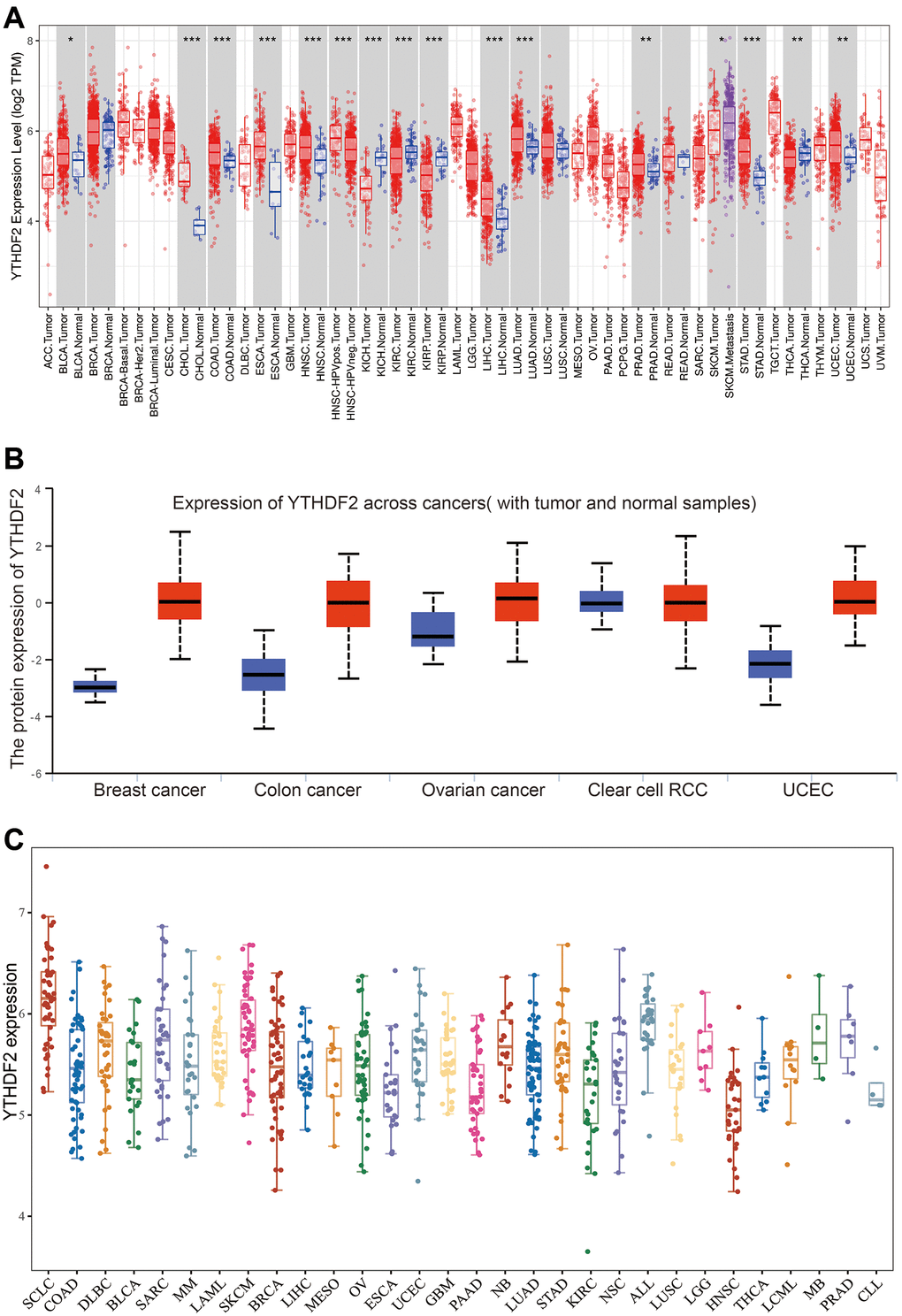 The expression of YTHDF2 in human cancer. (A) The expression of YTHDF2 in pan-cancer examine by TIMER database. (B) The protein level of YTHDF2 in diverse cancer examine by the UALCAN database. (C) The expression of YTHDF2 in diverse cancer cell lines examined by CCLE database.
