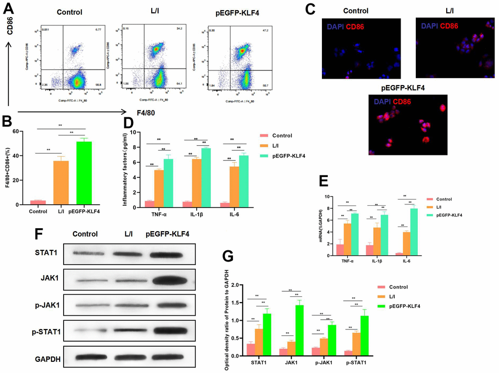 Effect of KLF4 overexpression on M1 polarization of macrophages. (A, B) The proportion of M1 cells was detected by flow cytometry (n=3): KLF4 overexpression (pEGFP-KLF4) promoted the M1 polarization of macrophages and increased the F4/80+CD86+ cell proportion. **PC) IF staining of CD86 expression (n=3). KLF4 overexpression (pEGFP-KLF4) promoted CD86 expression and increased the fluorescence intensity. (D) Expression of M1 cell marker proteins (n=3, TNF-α, IL-6, IL-1β). KLF4 overexpression (pEGFP-KLF4) up-regulated the expression of inflammatory factors TNF-α, IL-6 and IL-1β. **PE) Expression of mRNA (n=3, TNF-α, IL-6, IL-1β). KLF4 overexpression (pEGFP-KLF4) up-regulated the expression of mRNA. **PF, G) Expression of JAK1-STAT1 signal proteins (n=3). KLF4 overexpression promoted the expression of JAK1 and STAT1 proteins, increased their phosphorylation levels. **P