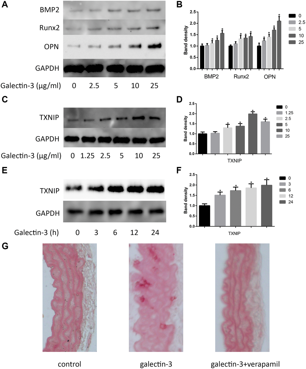 Galectin-3 induced aorta and VSMCs calcification. Cells were treated with galectin-3 over a range of concentrations (0, 2.5 μg/ml, 5 μg/ml, 10 μg/ml, 25 μg/ml) for 24 h, VSMCs osteogenic differentiation proteins (BMP2, Runx2 and OPN) were measured by Western blot, the quantification result is shown in the right panel (A and B). VSMCs were treated with galectin-3 over a range of concentrations (0, 1.25 μg/ml, 2.5 μg/ml, 5 μg/ml, 10 μg/ml, 25 μg/ml) for 24 h, TXNIP expression was measured by Western blot (C), the quantification result is shown in the right panel (D). 10 μg/ml galectin-3 was used to deal with VSMCs for different times (0, 3 h, 6 h, 12 h, 24 h), TXNIP expression was measured by Western blot (E), the quantification result is shown in the right panel (F). Band density of native VSMCs was defined as a control and considered to 1. Representative images of Alizarin Red staining of aorta (G). All experiments were performed at least three times. *P 