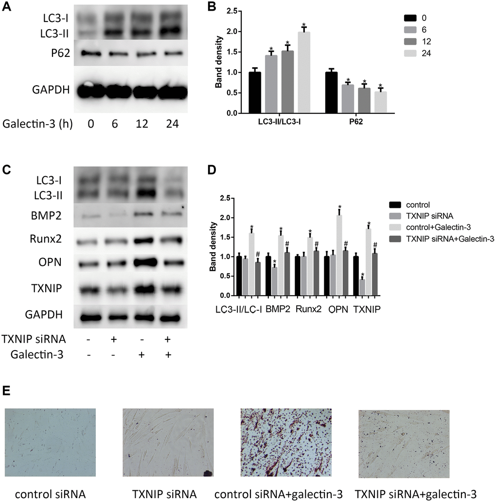 Galectin-3 induced VSMCs calcification and autophagy via TXNIP. VSMCs were treated with 10 μg/ml galectin-3 for different times (0, 6 h, 12 h, 24 h). The protein expression level of LC3-II/LC3-I and P62 were measured by western blot, the results quantifications were shown in the right panel (A and B). After transfection with either control or TXNIP siRNA for 24 h, VSMCs were incubated in the absence or presence of 10 μg/ml galectin-3 for 24 h, the expression of LC3-II/LC3-I and VSMCs osteogenic differentiation proteins (BMP2, Runx2 and OPN) was measured by western blot, the results quantifications were shown in the right panel (C and D). Band density of native VSMCs was defined as a control and considered to 1. After transfection with either control or TXNIP siRNA for 24 h, VSMCs were incubated in the absence or presence of 10μg/ml galectin-3 for 7 d, Alizarin red staining was used to observe the calcium deposition (E). Data were obtained from three independent experiments. *P #P 