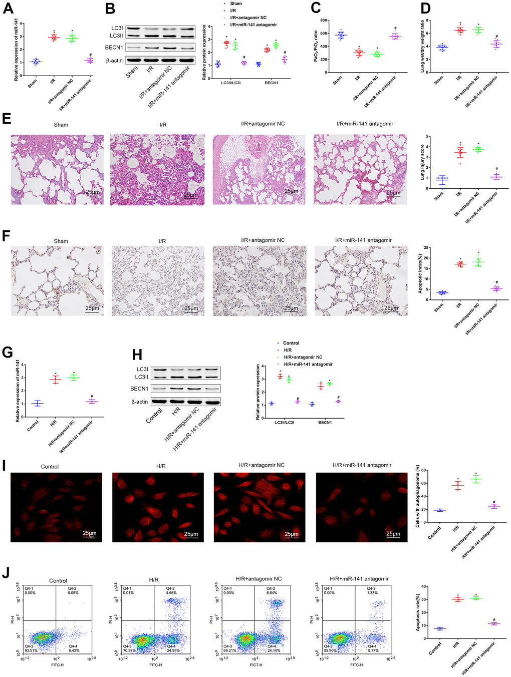 miR-141 inhibition suppresses autophagy and relieves lung I/R injury in vivo and in vitro. (A) RT-qPCR analysis for analyzing miR-141 levels within lung tissues of IRI mice. (B) Western blotting was used to detect the protein expression of LC3II/I and BECN1 in mouse lung tissues. (C) Blood gas analyzer was used to detect the blood gas in arterial blood in left ventricle of mice. (D) The statistical graph of W/D ratio of lung tissues of mice. (E) HE staining results of lung tissues (× 400) and lung injury scores. (F) TUNEL staining (× 200) was used to detect the apoptosis of mouse lung cells. (G) RT-qPCR analysis for analyzing the miR-141 expression in mouse PMVECs. (H) Western blotting was used to detect the protein expression of LC3II/I and BECN1 in mouse PMVECs. (I) LC3 immunofluorescence assay was used to detect autophagosomes. (J) flow cytometry assay was used to detect the apoptosis of PMVECs. * p 