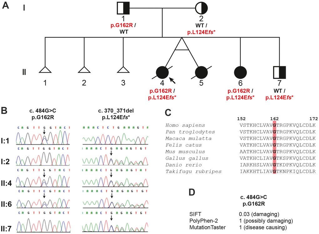 Pedigree analysis of the family in the study: (A) the pedigree showing the inheritance of the ERCC8 variants, (B) chromatograms for the variants verified by Sanger sequencing, (C) evolutionary conservation of ERCC8 p.G162, and (D) prediction of the effect of the missense variant.
