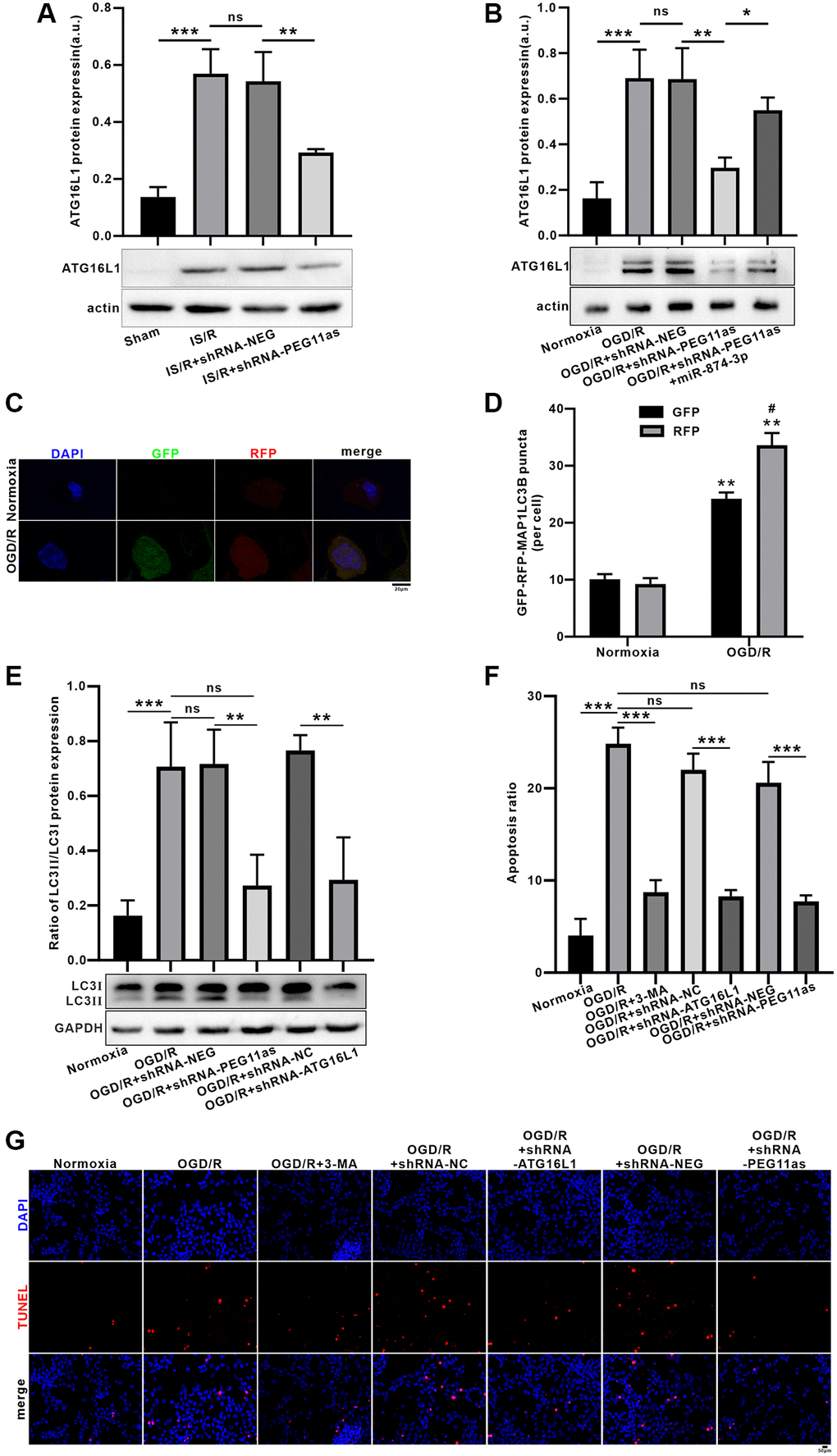 Inhibition of PEG11as alleviated OGD/R-induced apoptosis by ameliorating autophagic flux defects via miR-874-3p/ATG16L1 axis in N2a cells. (A) PEG11as silencing down-regulated ATG16L1 expression in tMCAO/R mice after transfection with sh-PEG11as. n = 6 animals/group. (B) PEG11as regulated ATG16L1 expression by sponging miR-874-3p. The cells were transfection with sh-PEG11as or co-treated with miR-874-3p inhibitor. 48 hours later, the cells were exposed to OGD 4 hours and 24 hours of Reperfusion in N2a cells. n = 3. (C, D) Knockdown of ATG16L1 ameliorate OGD/R-induced autophagic flux defects. (E) LC3-II/LC3-I ratio and p62 level were determined by western blot after transfection of ATG16L1 siRNA in N2a cells exposed to OGD/R. (F, G) TUNEL staining for analysis of the cell apoptosis after treated with 3-MA, sh-PEG11as or sh-ATG16L1, respectively. n = 3. One-way ANOVA followed by the Tukey’s post-hoc-test was used, data are shown as mean ± SD. Data are statistically different from each other with *P **P ***P 