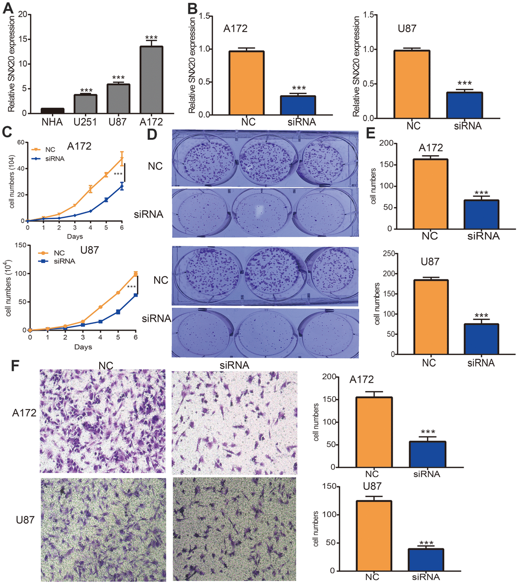 Depletion of SNX20 inhibits GBM cell proliferation and migration. (A) The expression of SNX20 in normal human astrocytes cells (NHA) and GBM cell lines (U87, A172 and U251). (B) The SNX20 knockdown efficiency in A172 and U87 cells were verified by qRT-PCR assay. (C–E) SNX20 knockdown significantly inhibited A172 and U87 cells proliferation examined by growth curve and colony formation assays. (F) SNX20 knockdown significantly inhibited A172 and U87 cells migration examined by transwell assay. Scale bar=50 μm. NC=Negative control, siRNA= SNX20 siRNA, * P 