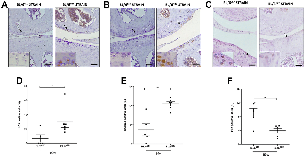 Immunohistochemistry for markers of autophagy on mouse knee joint sections. Representative images of medial compartment of knee joints from BL/6C57 and conplastic (BL/6NZB) mice at 90 weeks of age stained with LC3 (A), Beclin-1 (B) and P62 (C). Quantitative analysis of LC3-positive cells (D), Beclin-1-positive cells (E), and P62-positive cells (F) of knee joints from BL/6C57 and conplastic (BL/6NZB) mice at 90 weeks. Original magnification: 20×. Scale bar, 50 μm. Black arrow indicates positively stained chondrocyte. Chondrocyte magnification (40×) is shown in the bottom-left corner of the images. Graphs represent means ± SEM; n=5 in BL/6C57 and n=6 conplastic (BL/6NZB) mice for LC3 and Beclin-1, and n=6 in BL/6C57 and n=6 conplastic (BL/6NZB) mice for P62. *p