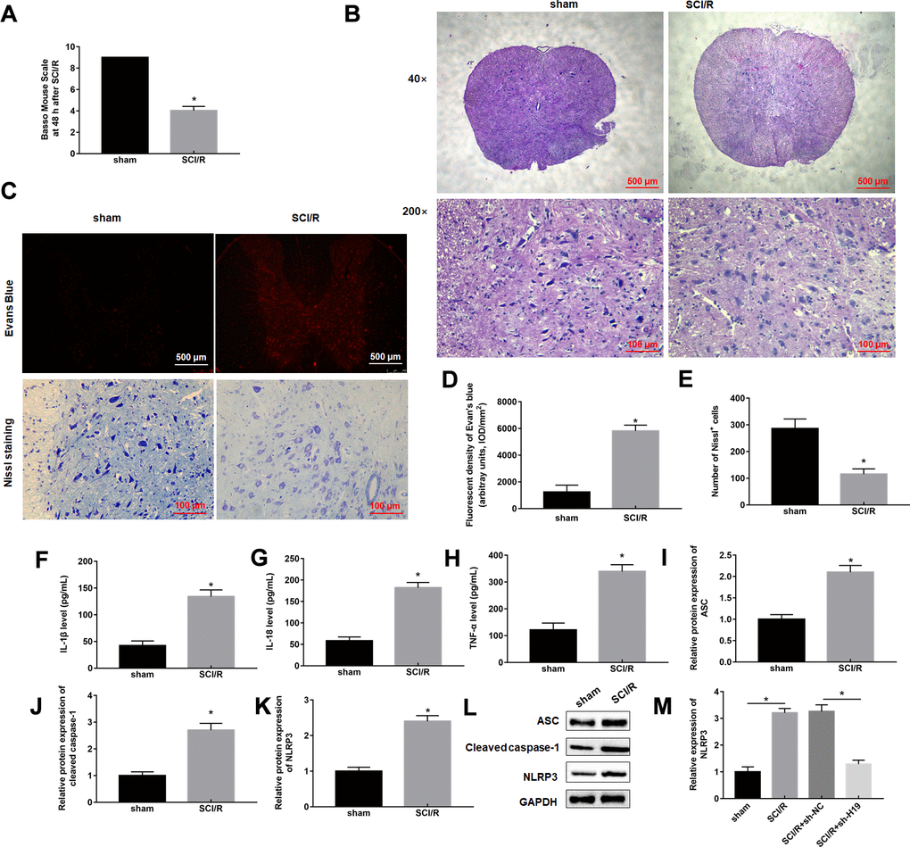 SCI/R induces pyroptosis and increases H19 expression level. Mice were subjected to SCI/R or sham surgery. (A) The locomotor function of the hind limbs was investigated by the BMS score in mice after SCI/R for 48 h. (B) Representative histomorphological changes in the ventral horn at 48 h of reperfusion (HE staining). (C) EB fluorescence and neuropathic damage were measured by EB and Nissl staining at 48 h post-injury, respectively. EB (D) and Nissl positive cells (E) were analyzed quantitatively, respectively. The levels of IL-1β (F), IL-18 (G), TNF-α (H) in serum of mice were determined by ELISA assay. (I–L) The protein levels of ASC, Cleaved-caspase-1, and NLRP3 were determined by Western blotting. (M) The expression levels of H19 in the mouse spinal cord tissues following SCI/R. The results were presented as the mean ± SD. N = 10; *P