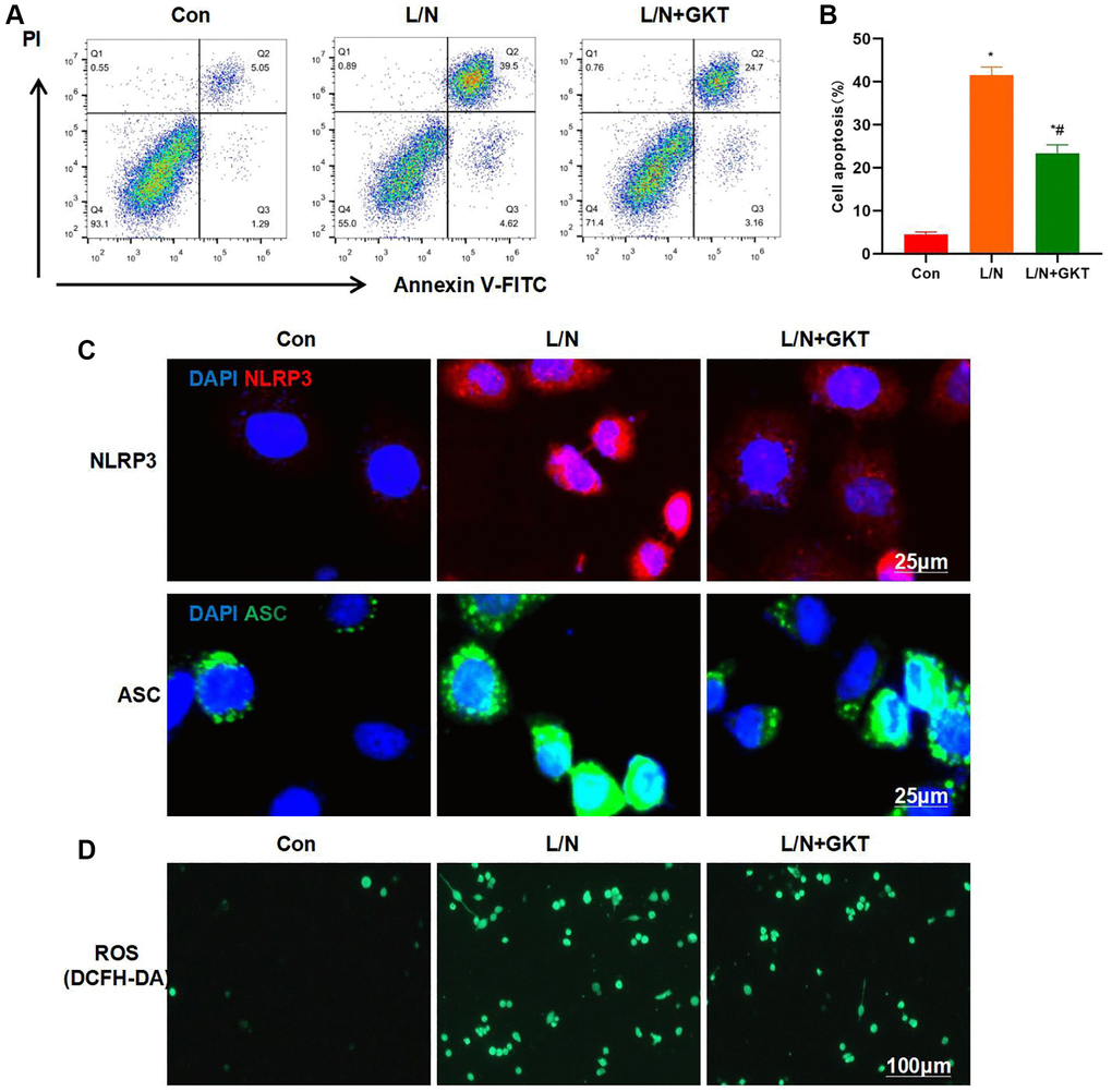 Suppressing NOX4 inhibits inflammatory response and injury in KCs. (A, B) Results of FCM assay (n = 3). The cell apoptosis level in L/N + GKT group significantly decreased, lower than that in L/N group. *P #P C) IF staining (n = 3). GKT suppressed NLRP3 inflammasome activation. The expression levels of NLRP3 and ASC evidently decreased, lower than those in L/N group. (D) ROS detection by DCFH-DA probe (n = 3). GKT inhibited ROS expression, and the number of positive cells markedly decreased, lower than that in L/N group.