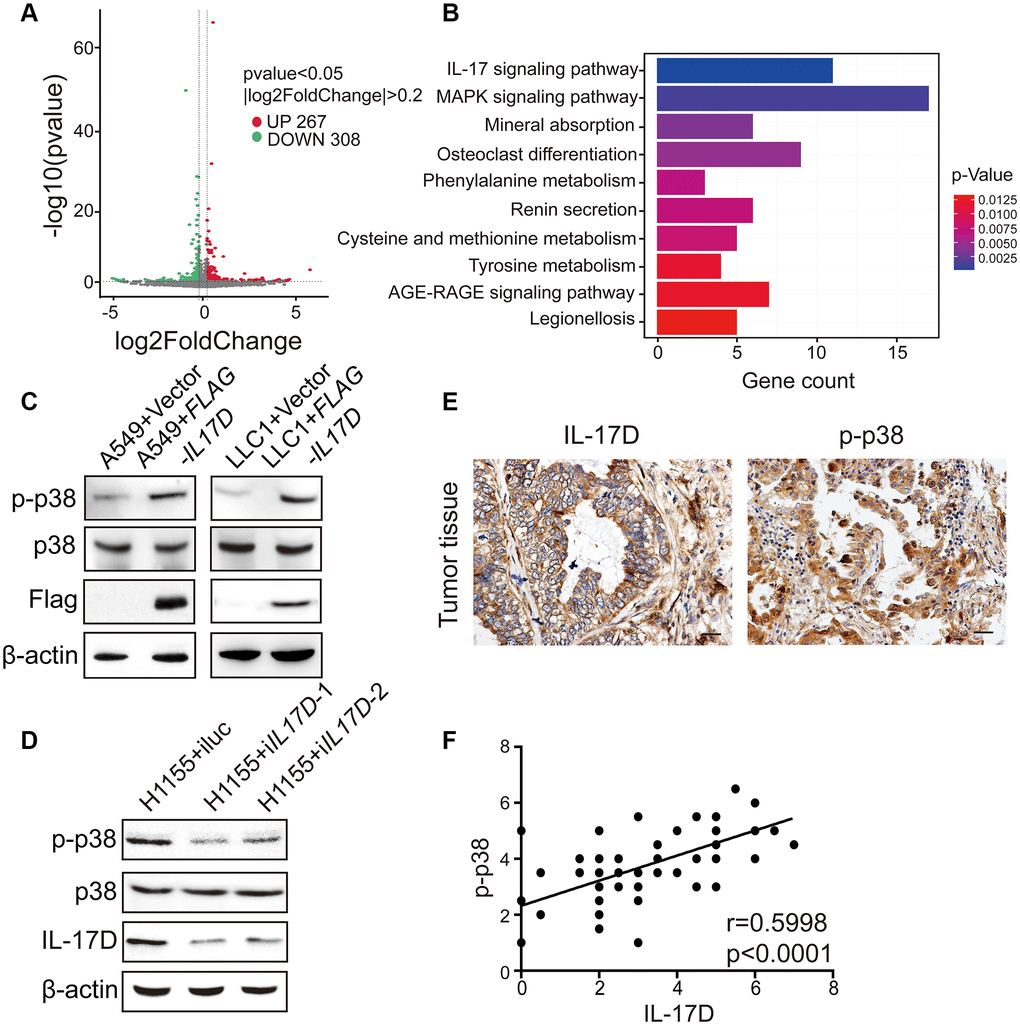 IL-17D activates p38 MAPK signaling pathway in lung cancer. (A) Volcano plot assessment of mRNA expression in A549 cells between IL-17D overexpression and control groups. (B) Significantly enriched KEGG pathways relative to differentially expressed mRNAs upon IL-17D overexpression. Y-axis represents pathways; X-axis represents the amount of the mRNAs enriched in KEGG pathways. (C) Immunoblots showing the expression of p38, p-p38, Flag and β-actin. Left, A549 cells were transduced with IL-17D or empty vector. Right, LLC1 cells were transduced with IL-17D or empty vector. (D) Immunoblots showing the expression of p38, p-p38, IL-17D and β-actin. H1155 cells were transduced with control or shRNAs against IL-17D. (E) Immunostaining of IL-17D and p-p38 in human lung cancer tissues. Scale bars are 20 μm. (F) Semiquantitative analysis of immunostaining revealed that IL-17D scores were associated with p-p38 scores (r = 0.5998, P 