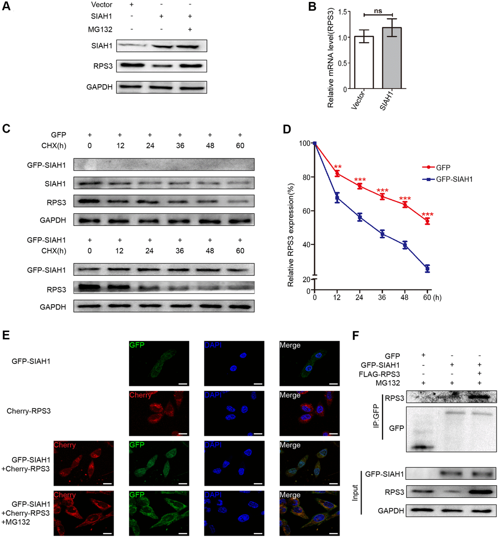 SIAH1 induces degradation of RPS3 protein. (A) A2780 cells were transfected with the Vector, SIAH1. Cells were treated with or without 10 μM MG132 for 6 h before cell lysis. and the resulting cell lysates were subjected to Western blotting. (B) RPS3 mRNA levels was detected in A2780 cells with SIAH1 overexpression. (C, D) The RPS3 protein half-life was assayed by using CHX (30 μg/ml) in HEK293T cells transfected with GFP or GFP-SIAH1 plasmid. The relative remaining RPS3 protein levels following CHX treatment at each time point were calculated accordingly. (E) Colocalization of RPS3 and SIAH1. The GFP-SIAH1 or Cherry-RPS3 plasmids were transfected into A2780 cells. Cells were treated with or without 10 μM MG132 for 6 h before cell lysis. GFP-SIAH1 was detected using a fluorescence microscope with an excitation wavelength of 488 nm. Cherry-RPS3 was detected with an excitation wavelength of 556 nm. The cell nuclei were stained with DAPI. Scale bar: 50 μm. (F) A2780 cells were transfected with plasmids as indicated, and the RPS3 protein was pull down with GFP antibody. Cell lysates were subjected to Western blotting. *p ***p 