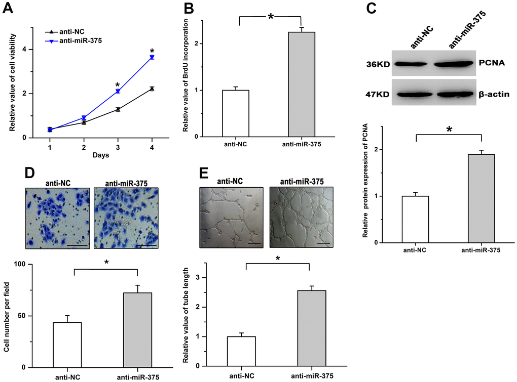 Inhibition of miR-375 promotes cell proliferation and angiogenesis in RMECs. (A) Cell viability was increased by the inhibition of miR-375 in RMECs. (B, C) The incorporation of BrdU (B) and the protein levels of PCNA (C) were facilitated by the treatment with anti-miR-375. (D, E) The inhibition of miR-375 enhanced cell migration (D) and tube formation (E) in RMECs. Scale bar: 100 μm (D) and 500 μm (E), respectively. All values are represented as the mean ± standard error of the mean. n = 3 per group. *P 