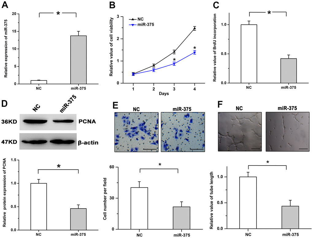 MiR-375 mitigates cell proliferation and angiogenesis. (A) Expression of miR-375 was significantly increased after the treatment with miR-375 in RMECs. (B) Cell viability was decreased by treatment with miR-375. (C, D) miR-375 inhibited the incorporation of BrdU (C) and the protein levels of PCNA (D). (E, F) Cell migration (E) and tube formation (F) were repressed by miR-375 in RMECs. Scale bar: 100 μm (E) and 500 μm (F), respectively. All values are represented as the mean ± standard error of the mean. n = 3 per group. *P 