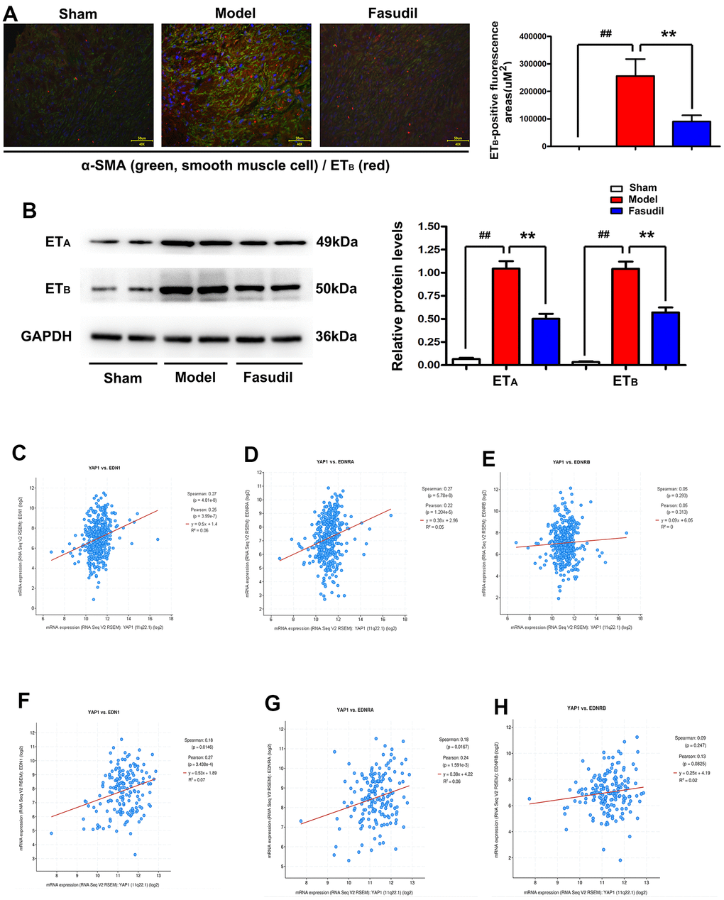 Fasudil restrained the YAP1/ETB/ETA signaling pathway in arterial smooth muscle tissues of rabbits. (A) Immunofluorescence staining indicated decreased immunofluorescence of ETB in Fasudil group compared with that in Model group. Pvs. Model group. (B) Western blotting showed that Fasudil treatment inhibited the expressions of ETA and ETB proteins. (C–E) Co-expression analysis revealed that YAP1 was significantly correlated with EDN1 (ETA) and EDN2 (ETB) based on the data from the GSE60887 dataset. Pvs. Sham group. (F–H).