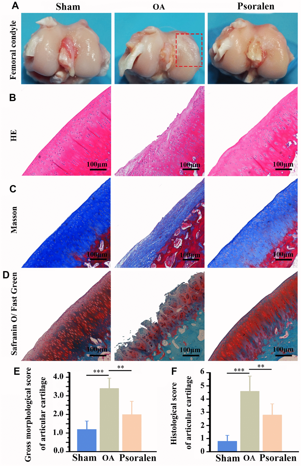 Intra-articular injection of psoralen significantly promoted OA rabbit model cartilage regeneration in vivo. (A) Macroscopic observation of femoral condylar cartilage. (B) HE staining, (C) Masson staining, (D) Safranin O/Fast Green staining, (E) Gross morphological score, (F) Histological score. The lower score, the smaller the cartilage damage and the better the repair effect. ** represents P 