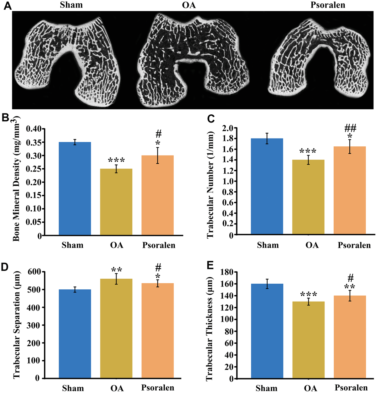 Psoralen Downregulates Osteoarthritis Chondrocyte Inflammation Via An ...