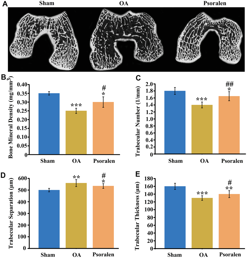 Psoralen promotes regeneration of bone mass in subchondral bone of rabbit OA. (A) Cross-sectional scan views of the subchondral bone of femoral condyles, (B) quantitative statistics of bone density, (C) trabecular number, (D) trabecular separation, (E) trabecular thickness. * represents P 