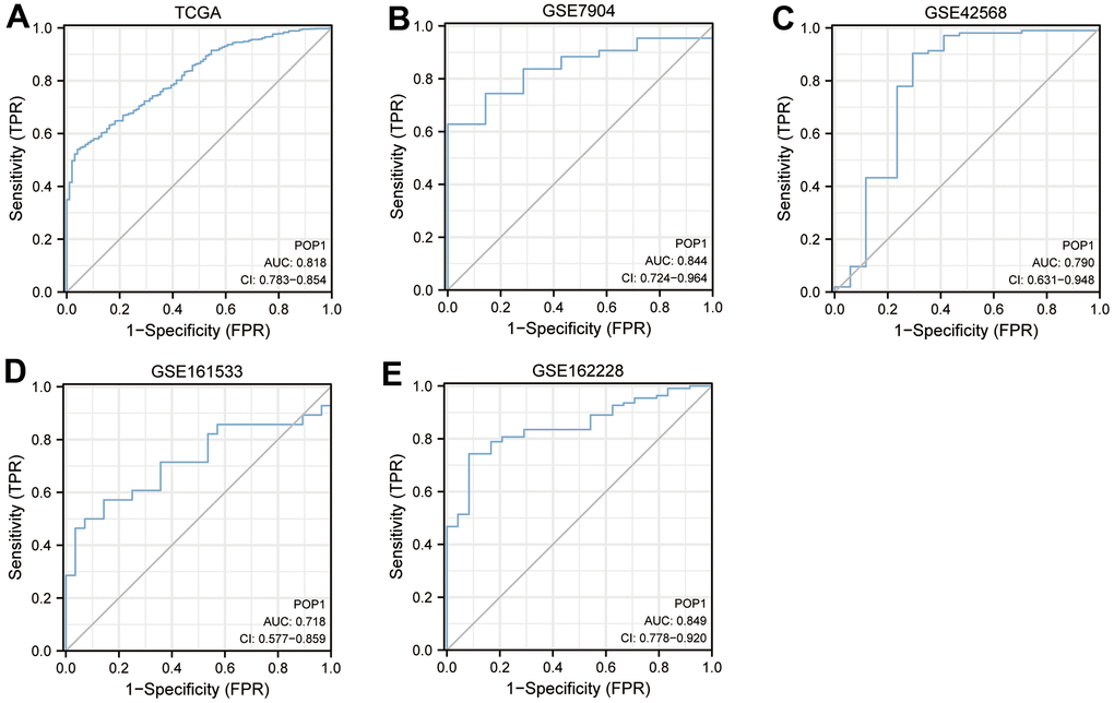 Diagnosis value of POP1. The receiver operating characteristic (ROC) curve to obtain the area under the curve (AUC) value of POP1 in different BC cohorts. (A) The Cancer Genome Atlas (TCGA) cohort. (B) GSE7904. (C) GSE42568. (D) GSE61533. (E) GSE162228. Abbreviations: ROC, Receiver operating characteristic; AUC, Area under the curve; TCGA, The Cancer Genome Atlas.