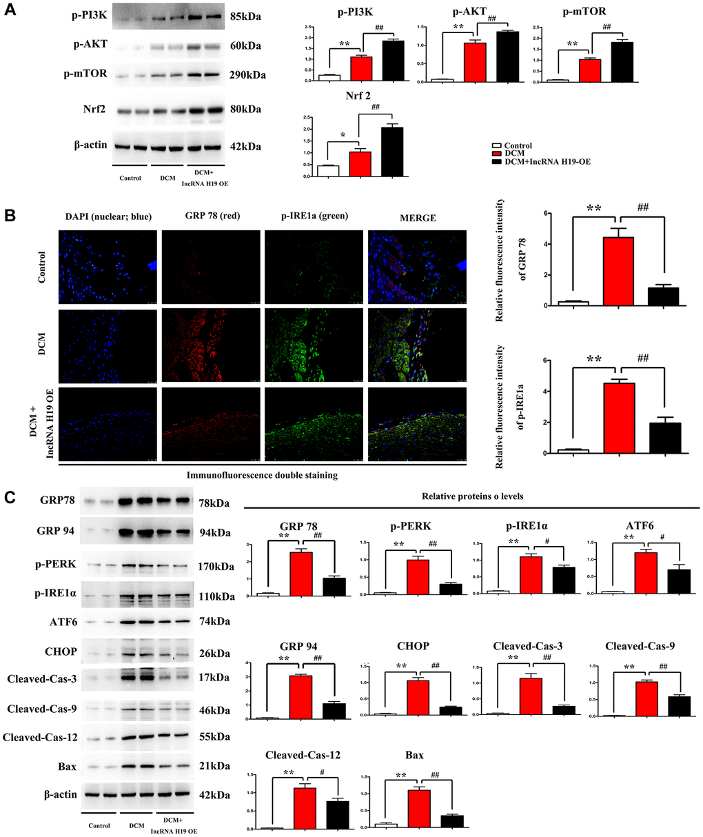 Effect of H19 on ERS-associated apoptosis markers and PI3K/AKT/mTOR pathway in DM. (A) Protein bands exposed the expression of p- PI3K, AKT and mTOR, Nrf2 in each group. (B) Immunofluorescence intensity of GRP78 and p-IRE1a in each group. (C) protein levels of p-PERK, p-IRE1α, ATF6, CHOP, cleaved caspase-3, cleaved caspase-9, cleaved caspase-12, and BAX proteins in all groups. #P ##P *P **P n = 6/group.