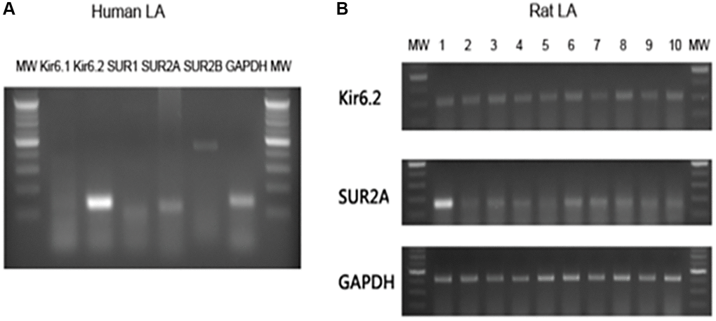 Basal expressions of KATP subunits in the human and rat atria. Total ribonucleic acid was isolated and reverse transcription-polymerase chain reaction products with specific primer pairs were visualized by electrophoresis. (A) The polymerase chain reaction results of human left atrial tissue. (B) The polymerase chain reaction results of 10 rat left atrial samples. Abbreviations: bp: base pair; GP: glyceraldehyde 3-phosphate dehydrogenase; MW: molecular weight maker.