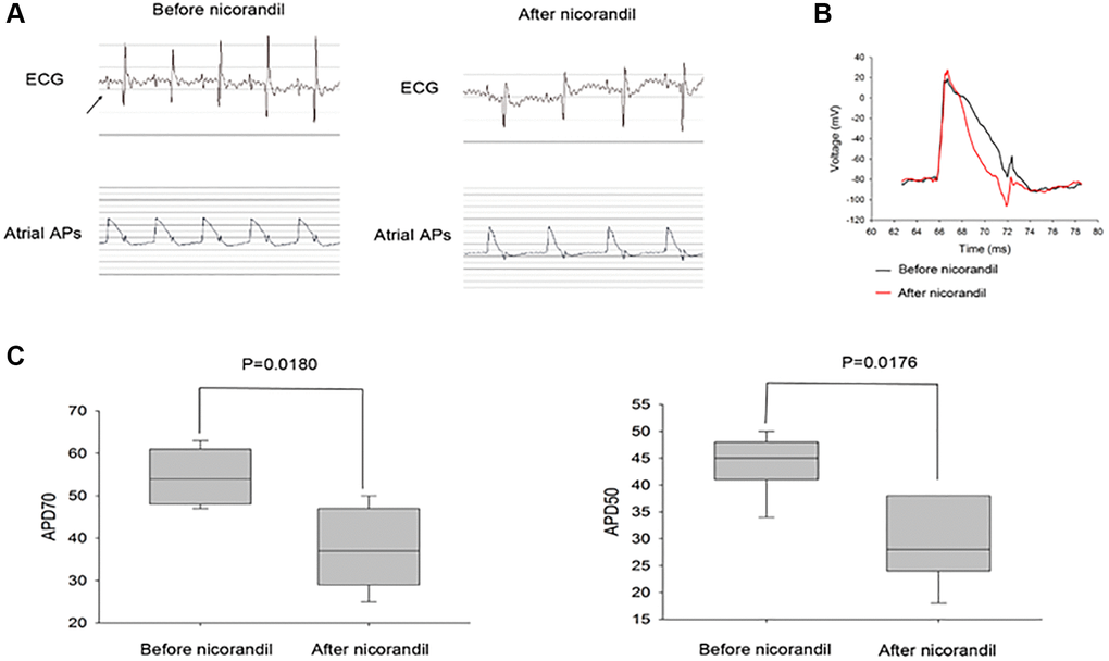 Nicorandil shortens rat atrial action potential duration. (A) Representative spontaneous rat electrocardiogram (ECG) and atrial action potential duration (APD) tracings of before (left panel) and after (middle panel) nicorandil stimulation (1 mg/kg) are shown. Arrows denote P waves that correspond to atrial APDs. (B) Overlap of representative action potentials before (black) and after (red) nicorandil stimulation. (C) Summary data of the mean APD50 and APD70 before and after nicorandil stimulation (1 mg/kg) are shown (n = 7). The mean APD50 and APD70 are shorter after nicorandil stimulation (1 mg/kg). Data represent mean ± SD; p 