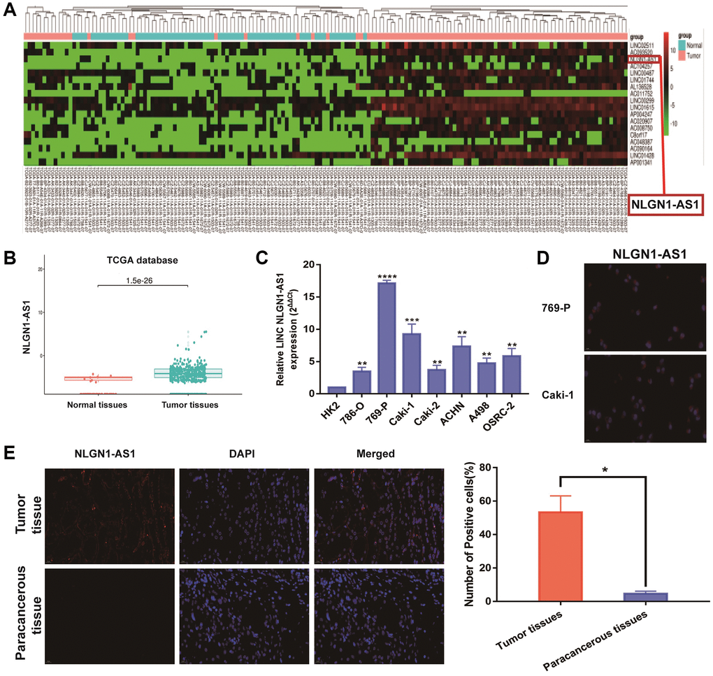 A regulatory circuit of lncRNA NLGN1-AS1 and Wnt signalling 