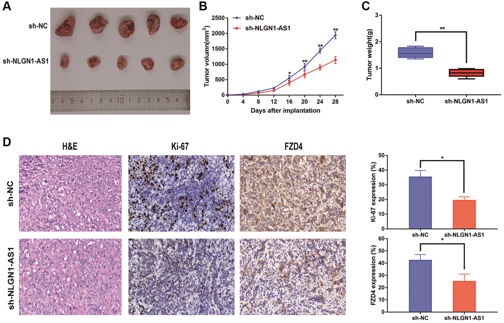 Reduced expression of NLGN1-AS1 markedly suppressed the proliferation of ccRCC cells in vivo. (A) The in vivo effect of NLGN1-AS1 was evaluated in xenograft mouse models bearing tumors originating from 769-P cells stably transfected with sh-NLGN1-AS1 or sh-NC, n = 5/group; Tumor volume and weight of the xenograft were shown in the right. (B) Tumor volume of the xenograft in each group. (C) Tumor weight of the xenograft in each group. (D) The tumor sections from sh-NLGN1-AS1 and sh-NC group of xenograft mouse models were subjected to H&E staining and immunohistochemistry staining using antibodies against ki-67 and PDZ4 (400×). The data represent the mean ± SD of 3 replicates. *P **P 