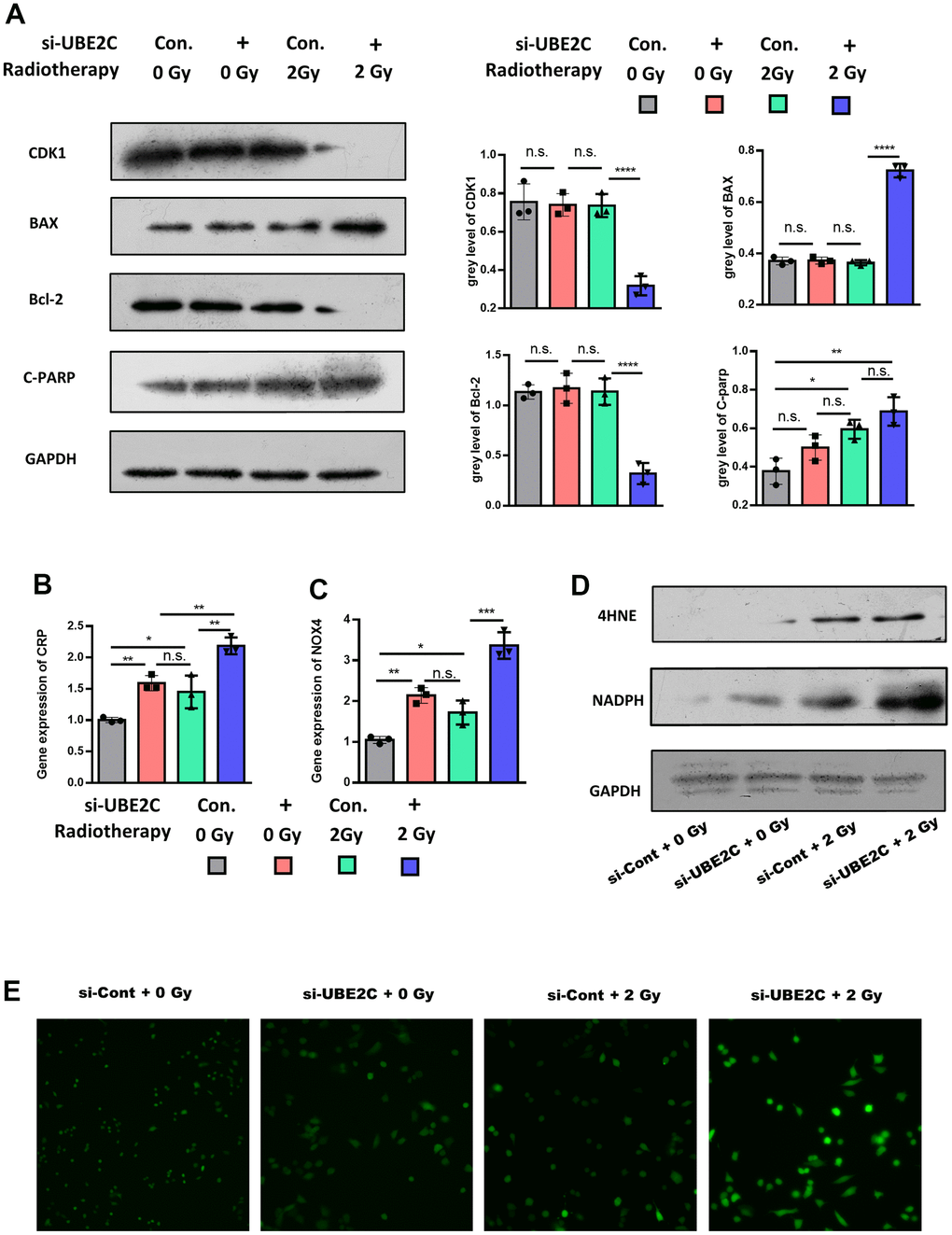 UBE2C confers radiotherapy resistance of HNSCC by regulating oxidative-stress-induced apoptosis through 4-HNE signaling. (A) Western blot results of proliferation relative protein (CDK1), anti-apoptosis relative protein (Bcl-2) and apoptosis relative protein (C-PARP, BAX) in Si-UBE2C/Cont CAL27 cells under 0/2 Gy radiation. (B) RT-PCR results of CRP gene expression in Si-UBE2C/Cont CAL27 cells under 0/2 Gy radiation after 24h. (C) RT-PCR results of NOX4 gene expression in Si-UBE2C/Cont CAL27 cells under 0/2 Gy radiation after 24h. (D) Western blot results of oxidative stress relative protein (4-HNE and NADPH) in Si-UBE2C/Cont CAL27 cells under 0/2 Gy radiation. (E) ROS level in Si-UBE2C/Cont CAL27 cells under 0/2 Gy radiation. *P 