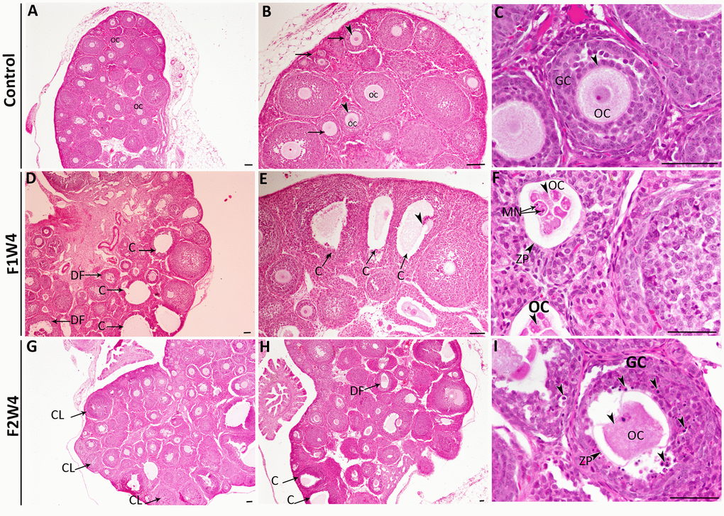 Histopathological changes in the ovaries from the first (F1W4) and the second generation (F2W4) compared to those in the control group (stained with H&E). (A–C) Photomicrographs at different magnifications of the same ovarian tissue section in females of control (CF1) showed normal structure containing normal growing follicles (arrows), normal oocytes (OC) (arrowheads), and a diminished number of pyknotic nuclei in granulosa cells (GC). (D, E) Photomicrographs of ovarian sections in treated females of F1W4 showing the presence of cysts (C), degenerated follicles (DF). (F) Segmented oocytes (arrowheads) enclosed by an irregular zona pellucida (ZP) with formation of micronucleus (MN). (G, H) Photomicrographs of ovarian sections in treated females of F2W4 showing a significant increase in growing follicle number and presence of corpora lutea (CL), there were a number of cysts (C) (arrows) and altered oocytes enclosed with abnormal zona pellucida (ZP), (I) in addition an elevation of pyknotic nuclei in granulosa cells (GC) (arrowheads). Scale bar = 60 μm.
