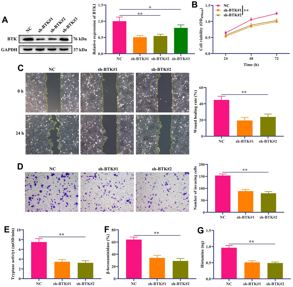 In vitro verification of the effect of BTK on the proliferation and metastasis of HMC-1 cells. (A) Western blotting displayed the knockdown efficiency of sh-BTK. (B) HMC-1 cell proliferation was detected by CCK-8 kit. (C) Wound-Healing assay showed the migration ability of HMC-1 cells. Scale bar: 100 μm. (D) Transwell assay was used to detect HCC-1 cell invasion. Scale bar: 100 μm. (E–G) Quantifications of mast cell mediators, including (E) Tryptase, (F) β-hexosaminidase and (G) Histamine. In all cases, Values are mean ± SD (n=3 for each group; *P