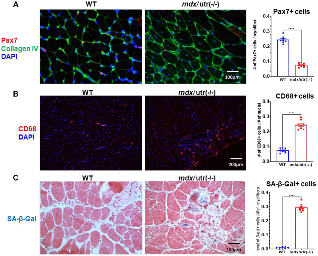 mdx/utro(−/−) muscle exhibits obvious stem cell exhaustion, immune cell infiltration and cellular senescence. (A) Immunofluorescent staining of Pax7 and Collagen type IV in muscle tissues of WT and mdx/utro(−/−) mice. (B) Immunofluorescent staining of CD68 in muscle tissues of WT and mdx/utro(−/−) mice. (C) Staining of SA-β-Gal in muscle tissues of WT and mdx/utro(−/−) mice. n = 8 mice/group for statistics, and data are presented as mean +/− SD.