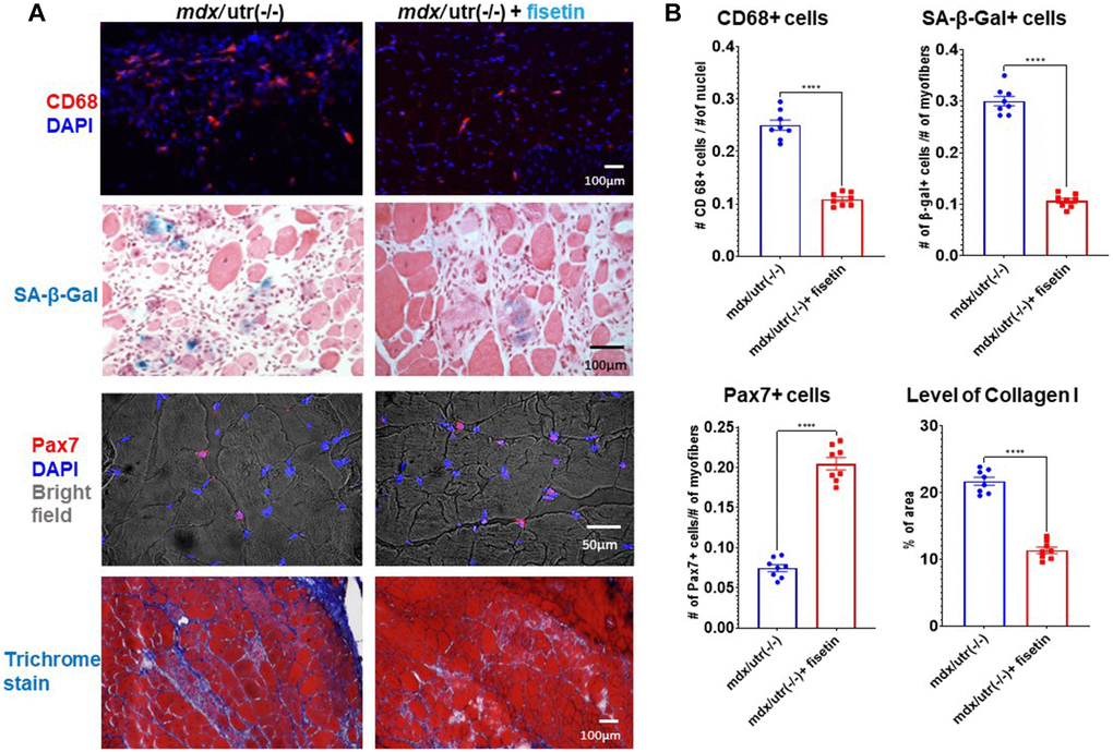 In vivo results of fisetin administration in mdx/utro(−/−) mice. (A) mdx/utro(−/−) mice were treated with fisetin via oral gavage (20 mg/kg for 5 consecutive days each week) for 4 weeks and muscle tissues were analyzed. Immunofluorescent staining of CD68 showed that the number of macrophages was decreased with fisetin administration; staining of SA-β-Gal showed that the number of senescent cells was decreased with fisetin administration; immunofluorescent staining of Pax7 showed that the number of MPCs was increased with fisetin administration; trichrome staining of collage deposition (fibrosis formation) showed that the amount of fibrosis formation was decreased with fisetin administration. (B) Statistics of in vivo results. n = 8 mice/group. Data are presented as mean +/− SD.