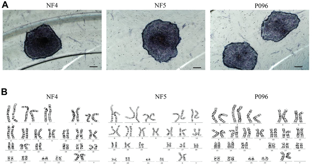 hESCs (NF4, NF5 and P096) grown on human foreskin fibroblast. (A) hESCs are positive for alkaline phosphatase staining. The scale bar was 200 μm. (B) Karyotype analysis revealed that these hESCs had a normal karyotype.