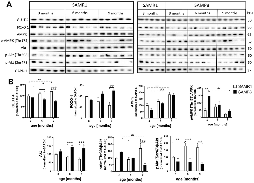 Increased insulin resistance in skeletal muscle of SAMP8 (A) western blots and (B) their quantification. Data are mean ± SEM, analyzed by 2-way ANOVA with Bonferroni post test. Significance is *P 