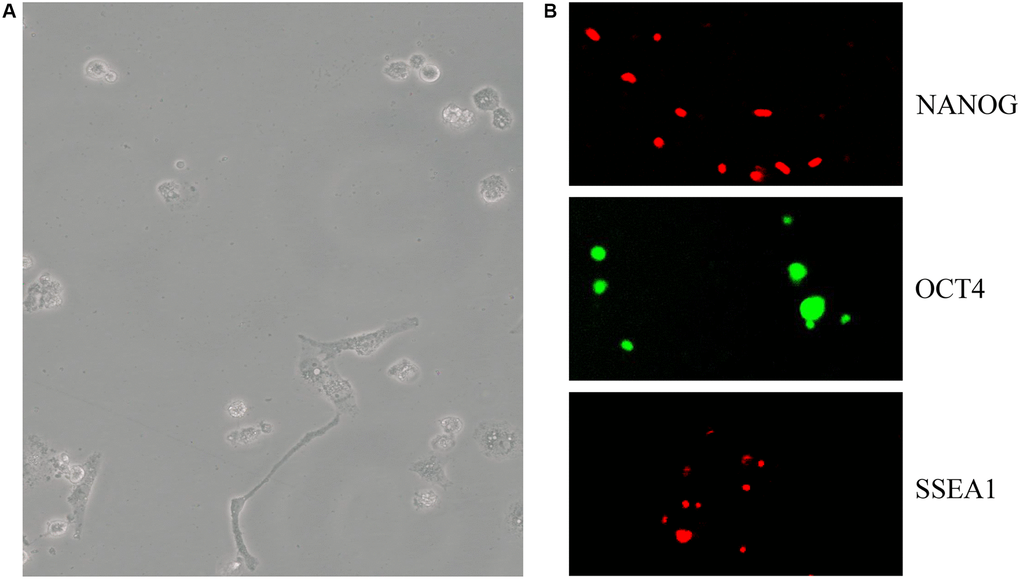 mESCs express pluripotency markers. (A) C57BL/6 mESC culture in OriCell C57BL/6 × 129 medium. (B) The pluripotency marker NANOG (red), OCT4 (green), SSEA1 (red) and staining was visualized through fluorescent microscopy. Abbreviation: mESCs: mouse embryonic stem cells.