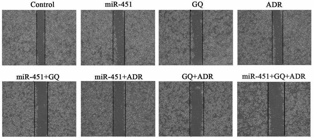 Effect of GQ and miR-451 on the migration inhibition of ADR to MCF-7/ADR cells. MCF-7/ADR cells or miR-451-transfected MCF-7/ADR cells were seeded on 6-well plates with monolayer and divided on average with a UV-sterilized ruler and pipette tips. Then the cells were treated with GQ (10 μM), ADR (43 μM) or their combination for 48 h and photographed using an inverted microscope.