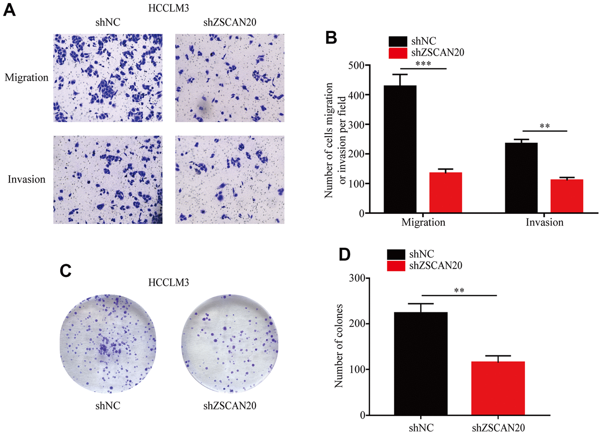 Comprehensive Analysis Of Prognostic Value Relationship To Cell Cycle