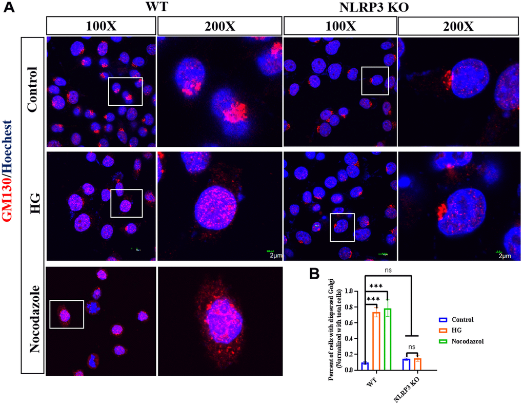 NLPR3 involves HG induced GA stress. (A) WT BV2 cells were treated with or without HG (35 mM) for 12h; WT BV2 cells were treated with nocodazole (10 μg/kg) for 5h, NLRP3 KO BV2 cells were treated with or without HG for 12 h, GM130 was detected by immunofluorescence. (B) The percent of cells with dispersed Golgi apparatus normalized with total cells were calculated. Bar = 2 μm. Data represent means ± SEM of 3 independent experiments. * p ≤ 0.05, ** p ≤ 0.01, and *** p ≤ 0.001 according to two-way ANOVA with Bonferroni’s post hoc test.