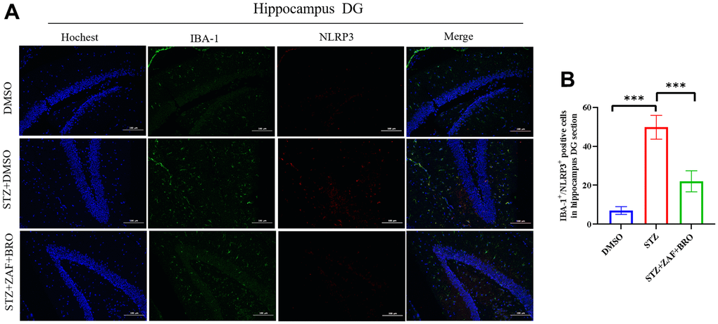 Immunofluorescence detection of NLRP3 expression in mice hippocampus DG section treated with NLRP3 inhibitor and Golph3 inhibitor. (A, B) Immunohistochemistry detection of NLRP3 in hippocampus DG section of mice in DMSO, STZ + DMSO, STZ + ZAF, STZ + BRO, STZ + ZAF + BRO groups. All data are presented as means ± SEM (n = 8/group). Bar=100μm. * p p 