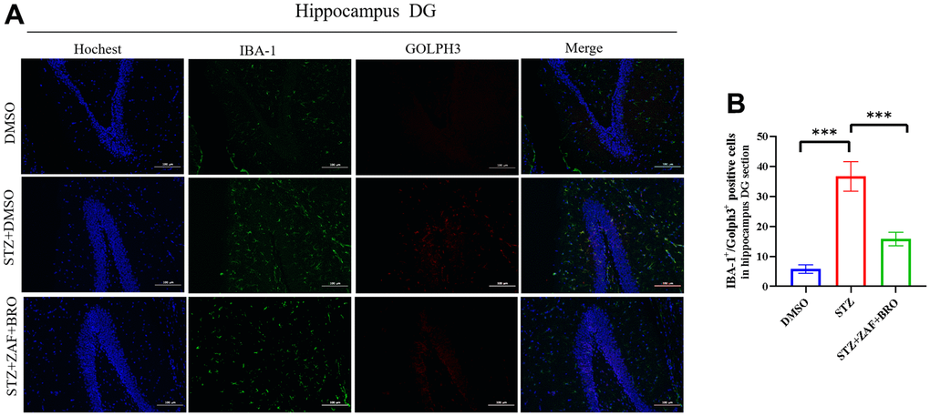 Immunofluorescence detection of Golph3 expression in mice hippocampus DG section treated with NLRP3 inhibitor and Golph3 inhibitor. (A, B) Immunohistochemistry detection of Golph3 in hippocampus DG section of mice in DMSO, STZ + DMSO, STZ + ZAF, STZ + BRO, STZ + ZAF + BRO groups. All data are presented as means ± SEM (n = 8/group). Bar=100μm. * p p 