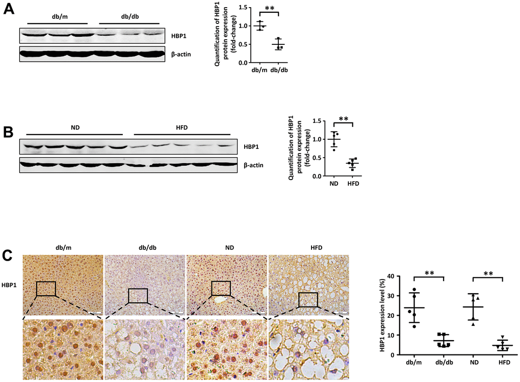 Hepatic HBP1 expression is low in mouse models of T2DM. (A) HBP1 protein level reduces in adult db/db mice. The protein of endogenous HBP1 was extracted from db/m and db/db mice (n=3) livers and was measured by western blotting. β-actin was detected as a loading control. Quantification was normalized to β-actin. (B) HBP1 protein level reduces in C57BL/6J mice fed by high fat diet. The protein of endogenous HBP1 was extracted from livers (n=5) of wild type (WT) C57BL/6J mice fed by normal diet (ND) and high fat diet (HFD), and was measured by western blotting. β-actin was detected as a loading control. Quantification was normalized to β-actin. (C) The HBP1 content in livers of type 2 diabetic model mice is low. Liver sections collected from db/m, db/db, ND and HFD mice (n=5) were immunohistochemically stained with anti-HBP1. Scale bar, 100 μm. Stained areas were quantitated by Image J software. Error bars represent S.D. **, p
