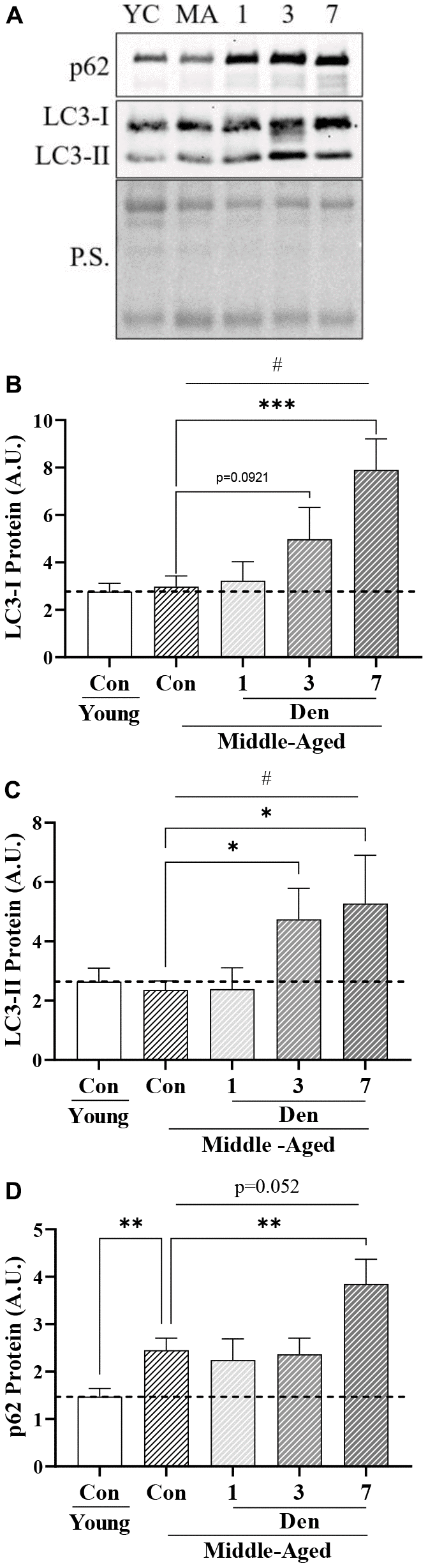 Autophagosomal proteins in young and middle-aged control and denervated skeletal muscle. (A) Representative western blots for LC3-I, II and p62 protein. Quantification of (B) LC3-I protein; (C) LC3-II protein; and (D) p62 protein in skeletal muscle. All values were corrected to Ponceau stain (P.S.), and values are reported as means ± SEM, in A.U. *p