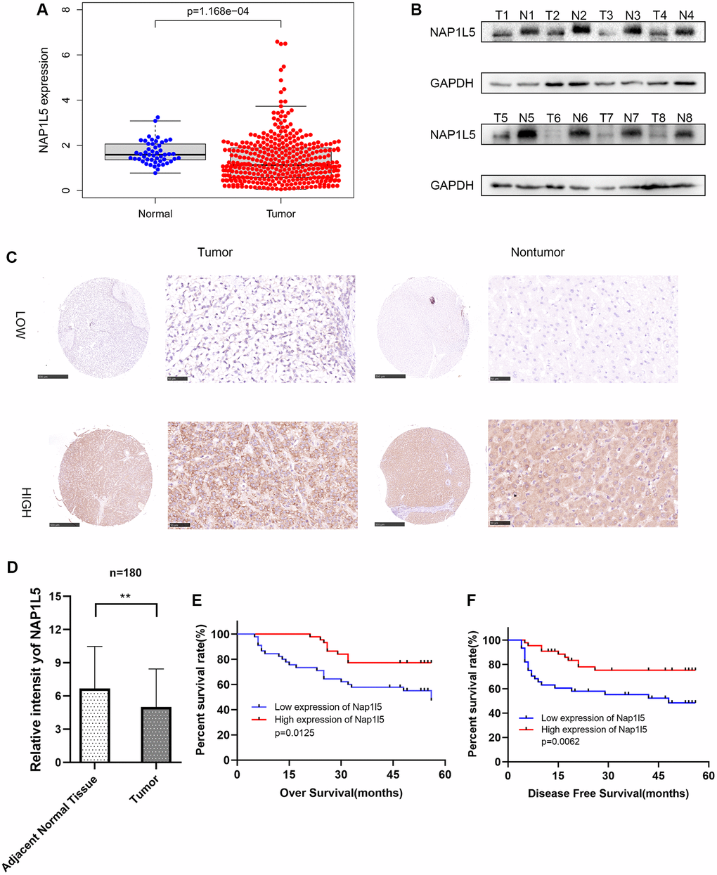 The expression of NAP1L5 in hepatocellular carcinoma is decreased and is related to poor prognosis. (A) The expression of the NAP1L5 gene in the TCGA database: 50 paracancerous tissues and 374 cancerous tissues. (B) The expression of NAP1L5 protein in 8 pairs of hepatocellular carcinoma (Tumor) and paracancerous tissues (Normal) was assessed. (C) Immunohistochemistry was used to detect the expression of NAP1L5 in the HCC tissue microarray. (D) The immunohistochemical score of 90 samples of HCC and paracancerous tissues in the tissue microarray. (E, F) Kaplan–Meier survival analysis was performed to evaluate the effect of NAP1L5 on disease-free survival and overall survival. *p **p ***p 