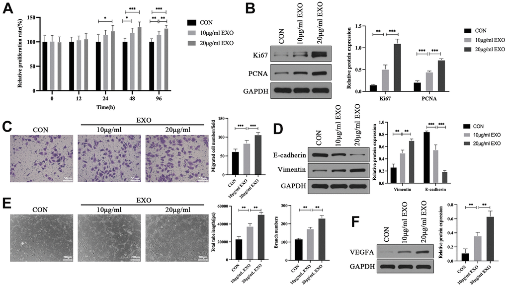 Adipocyte-derived exosomes promote proliferation, migration, and tube formation in HOMECs. (A) Detection of the effect of adipocyte-derived exosomes on the cell proliferation by the CCK-8 assay. (B) Western blotting analyses of Ki67 and PCNA expression in HOMECs. (C) Detection of the effect of adipocyte-derived exosomes on the cell migration by the transwell assay. (D) Western blotting analyses of E-cadherin and Vimentin expression in HOMECs. (E) Detection of the effect of adipocyte-derived exosomes on the cell tube formation by the tube formation assay. (F) Western blotting analyses of VEGFA expression in HOMECs. Data are presented as mean ± SD for three independent experiments. *P