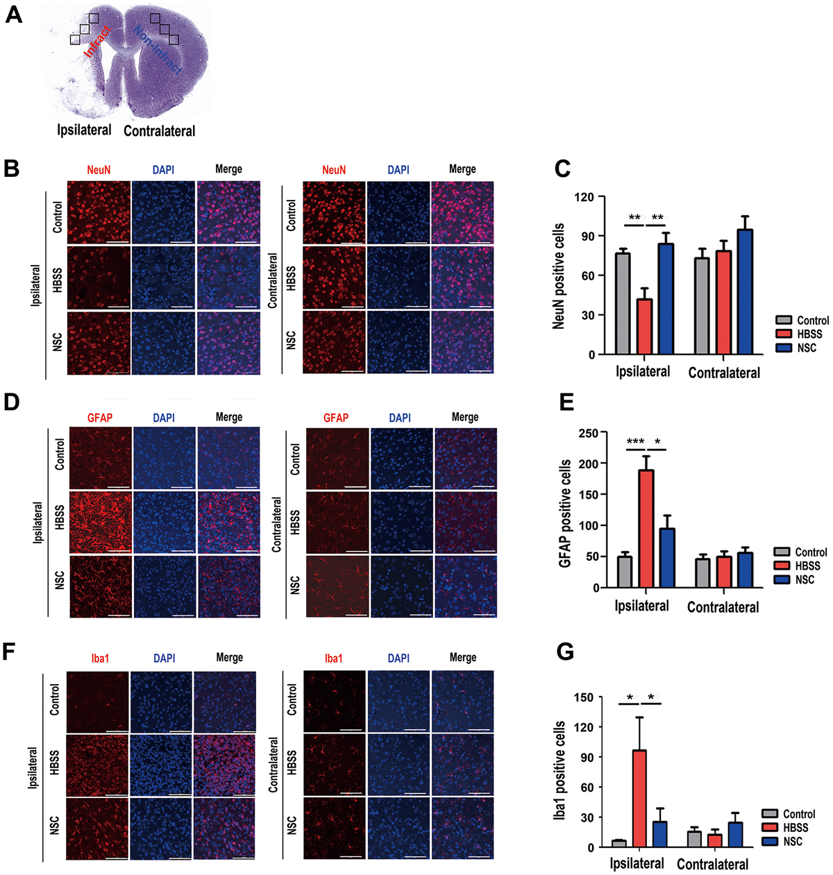 jak2-stat3-pathway-mediates-neuroprotective-and-pro-angiogenic