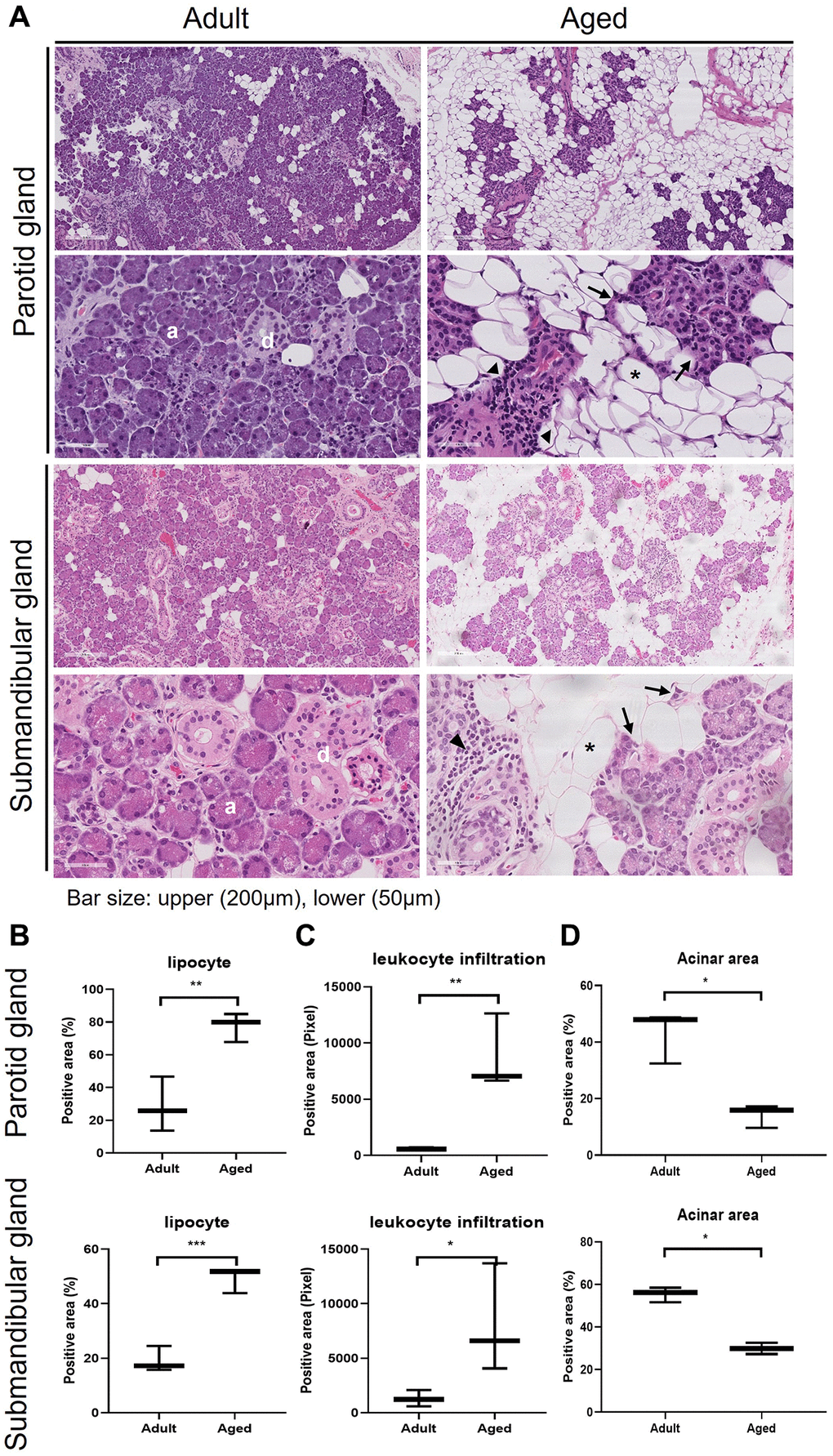 parotid histology