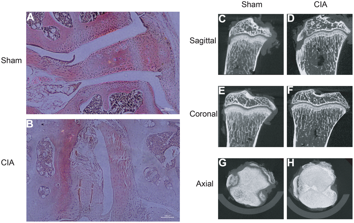 Identification And Validation Of Metabolism-related Genes Signature And ...